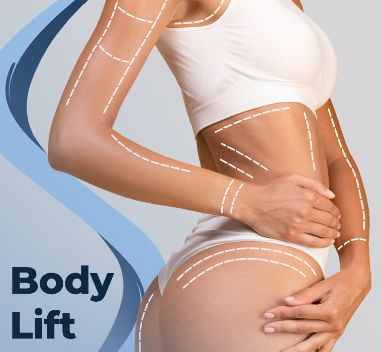 Body Lift